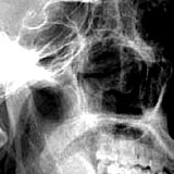 head_nail1.jpg