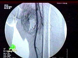 key_leg2