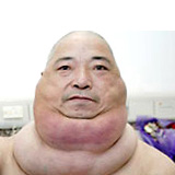 necktumor2.jpg